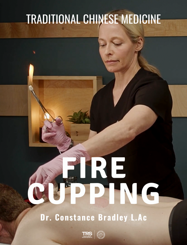 TCM Fire Cupping - 5 CE Hours